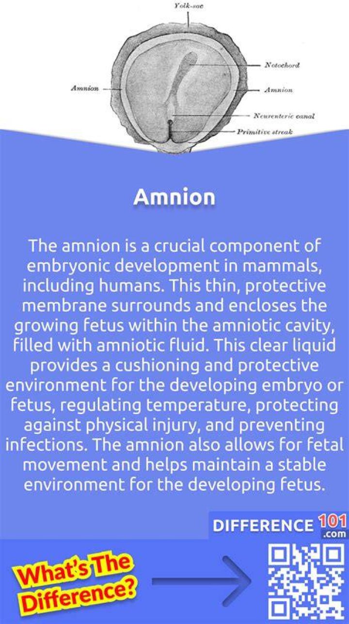 Amnion - How To Discuss