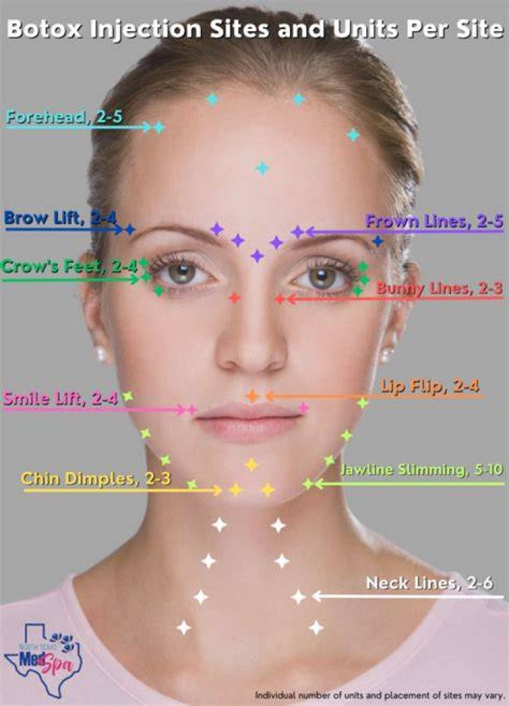 How Much is Botox - How To Discuss