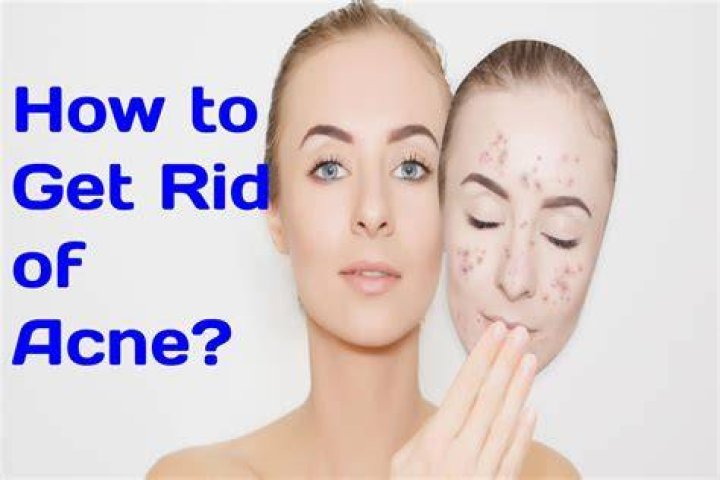 how to get rid of clogged pores