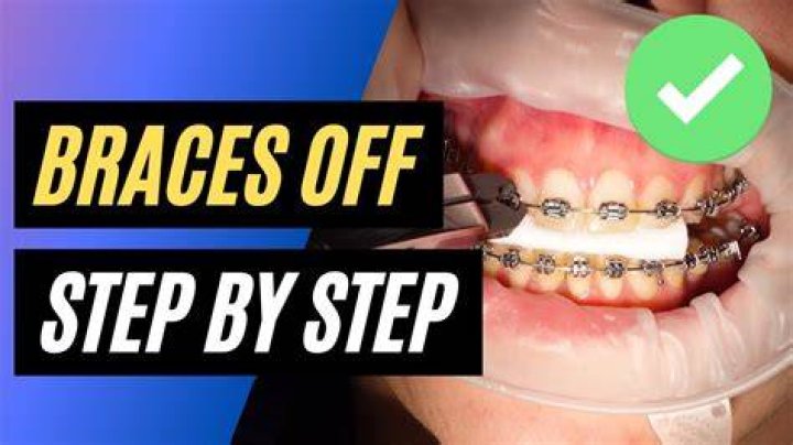 How To Take Braces Off Yourself