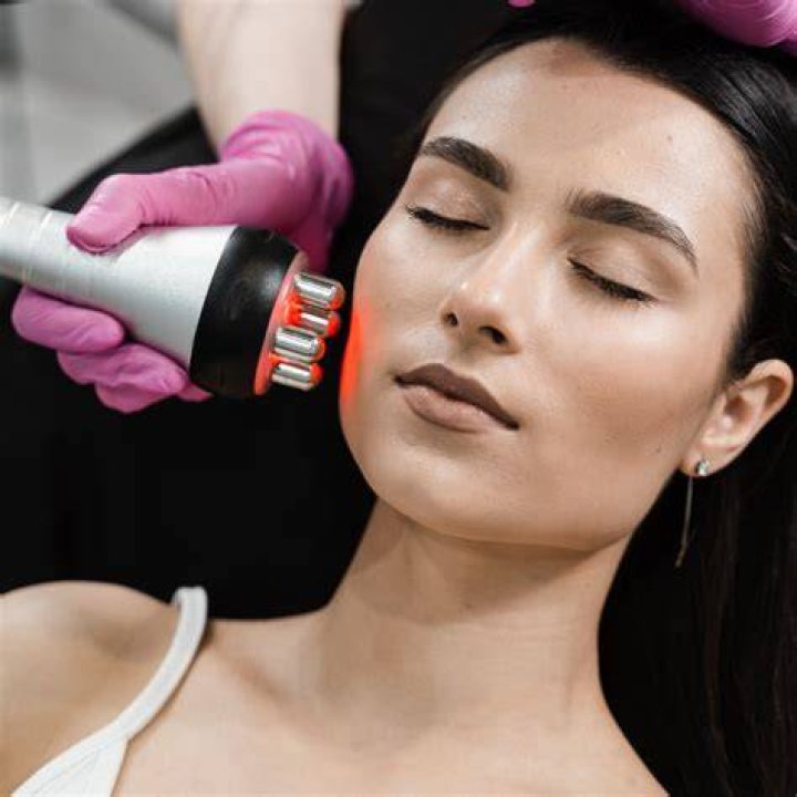 rf skin tightening